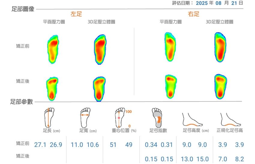 足弓塌陷令人全身痠痛 客製化鞋墊預防累積性傷害 2 《圖說》李老師經日常調整及足墊輔助,現已恢復活動力。〈臺北醫院提供〉
